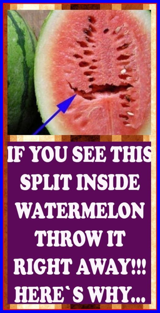 DO YOU LOVE WATERMELONS?? IF YOU SEE THIS SPLIT INSIDE WATERMELON THROW IT RIGHT AWAY!!! HERE’S WHY..