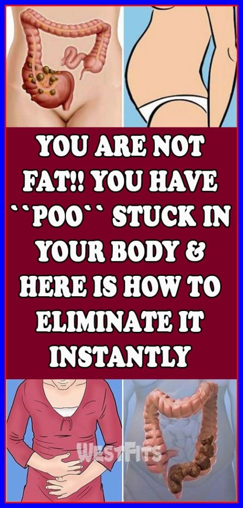 YOU ARE NOT FAT!! YOU HAVE “POO” STUCK IN YOUR BODY & HERE IS HOW TO ELIMINATE IT INSTANTLY
