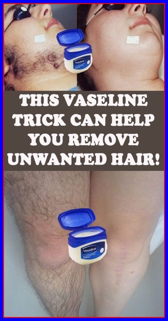 THIS VASELINE TRICK CAN HELP YOU REMOVE UNWANTED HAIR !