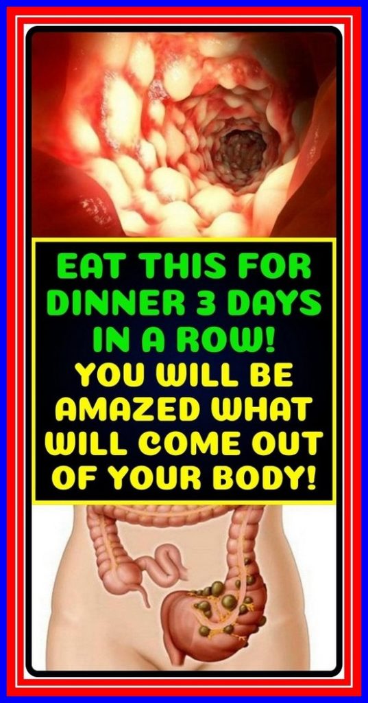 EAT THIS FOR DINNER 3 DAYS IN A ROW! YOU WILL BE AMAZED WHAT WILL COME OUT OF YOUR BODY!