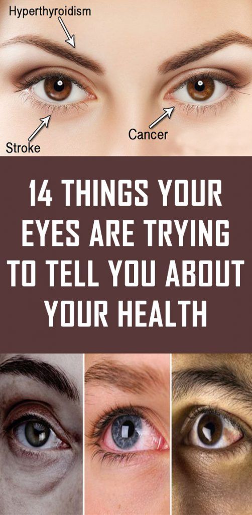 14 Things Your Eyes are Trying to Tell You About Your Health