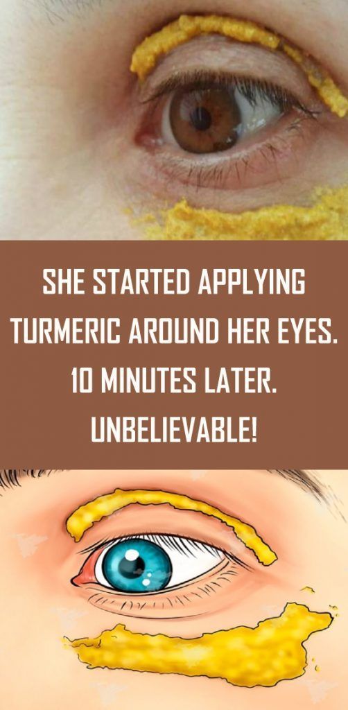 SHE STARTED APPLYING TURMERIC AROUND HER EYES, 10 MINUTES LATER UNBELIEVABLE
