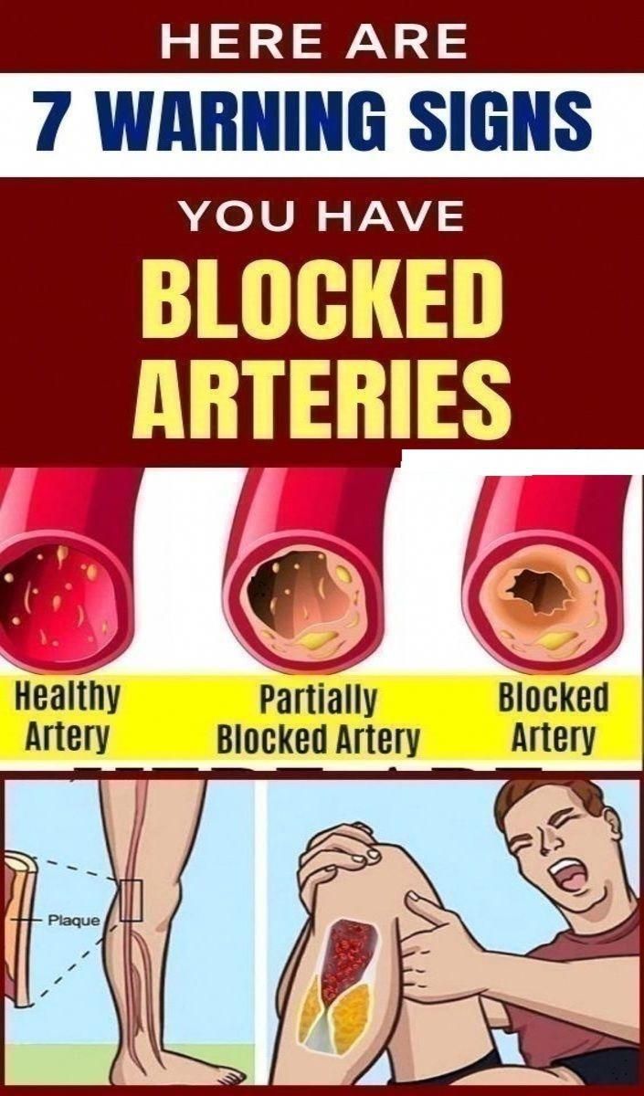 Here Are 7 Warning Signs You Have Blocked Arteries