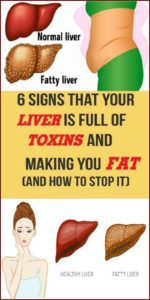 6 Signs That Your Liver is Full of Toxins